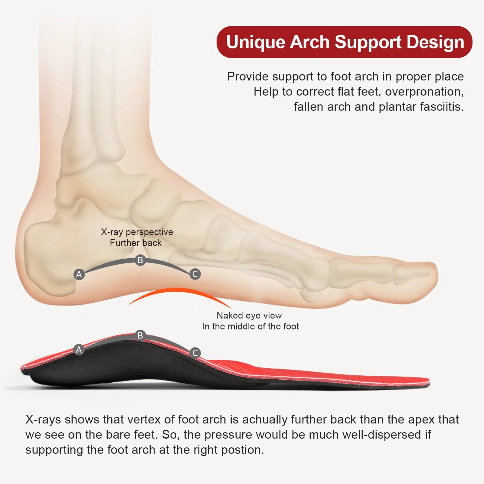 3ANGNI Arch Support Insoles for Plantar Fasciitis- Orthotic Inserts for Flat Feet Orthopedic Insoles Men Women, Metatarsal Support Insoles for Metatarsalgia, Pronation Insoles for Overpronation Valgus Men 10-10.5 / Women 12-12.5 Red